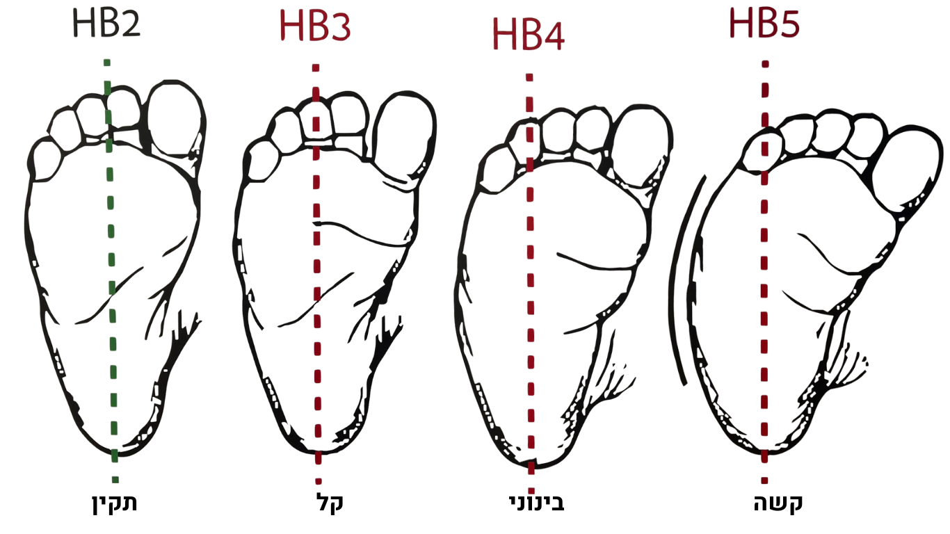 heel bisector line method